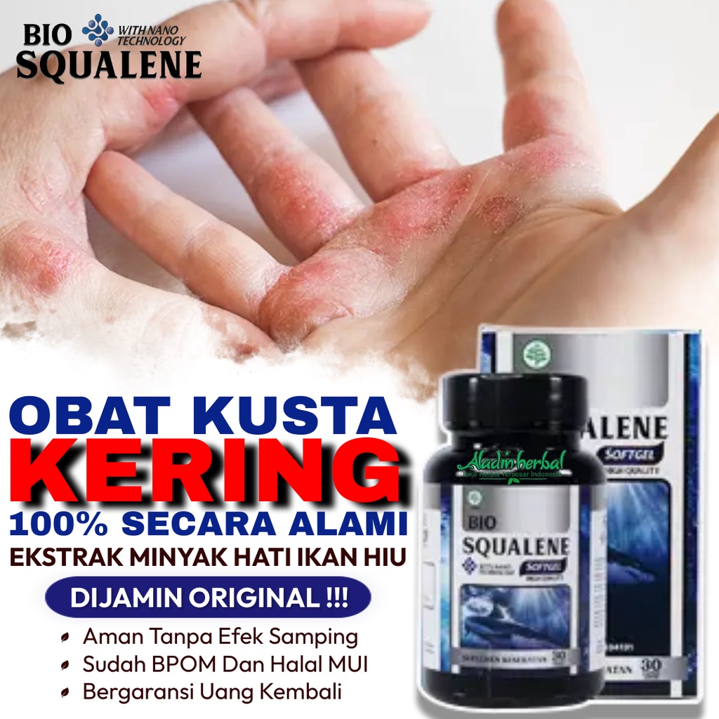 Jual Obat Kusta, Obat Lepra, Obat Kusta Kering, Obat Kusta Basah, Obat ...