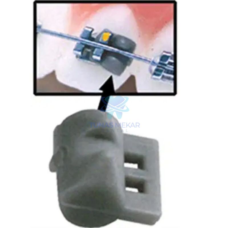 Jual Rotation Wedges Orthodontic Dental Shopee Indonesia