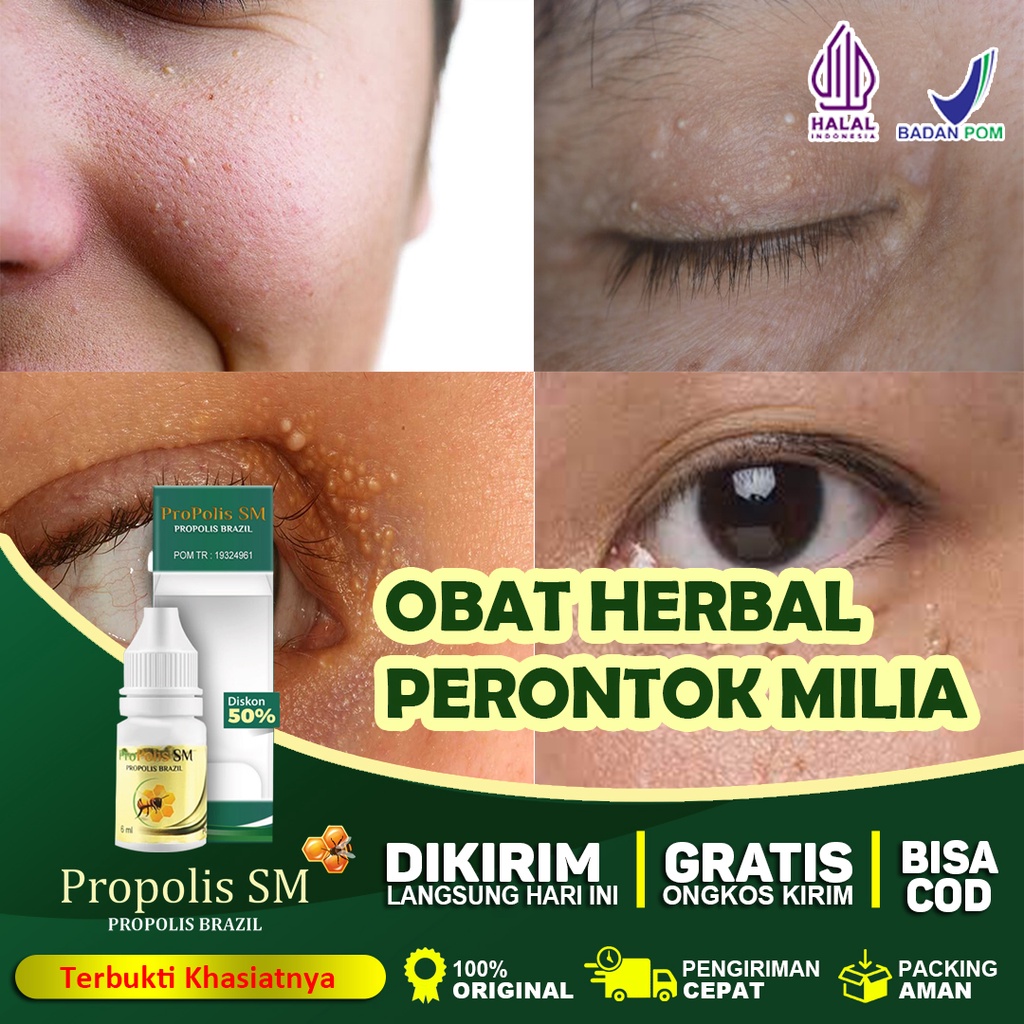 Skincare Penghilang Milia Di Apotik