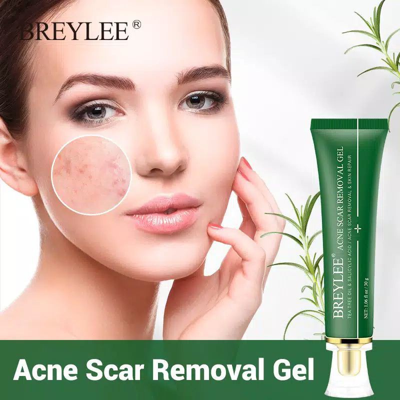 Jual Breylee Acne Scar Removal Gel Penghapusan Jerawat Bekas Luka