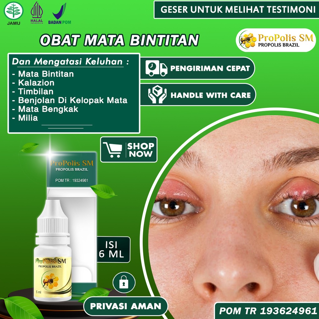 Jual Obat Mata Bintitan Benjolan Di Kelopak Mata Timbilan Milia Bintik Bintik Putih Bruntusan Di