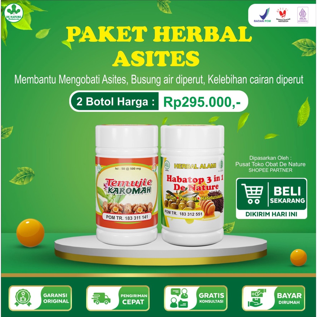 Jual Obat Asites Ampuh Acsites Busung Air Di Perut Kelebihan Cairan Air ...
