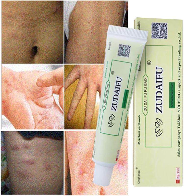 Jual Cream Salep Gatal Psoriasis Eksim Kurap Kutu Ampuh Salep 15grkrim Alergisalep Kulit 3790