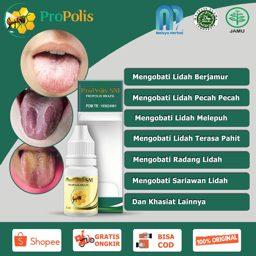 Jual Obat Lidah Putih Tebal Berjamur Pecah Pecah Melepuh Terasa Pahit