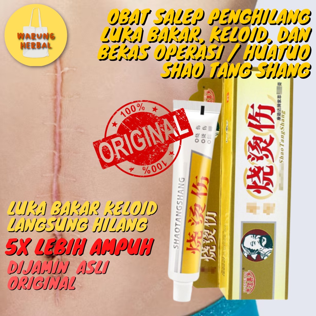 Jual Obat Salep Penghilang Luka Bakar Keloid Dan Bekas Operasi Huatuo Shao Tang Shang