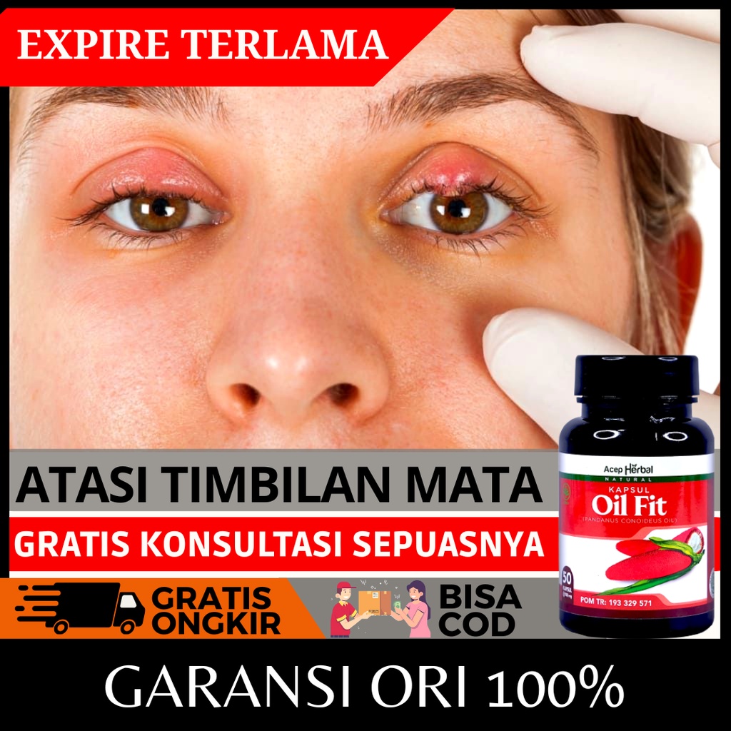 Jual Obat Timbilan Mata Pengempis Benjolan Di Kelopak Mata Penghilang ...