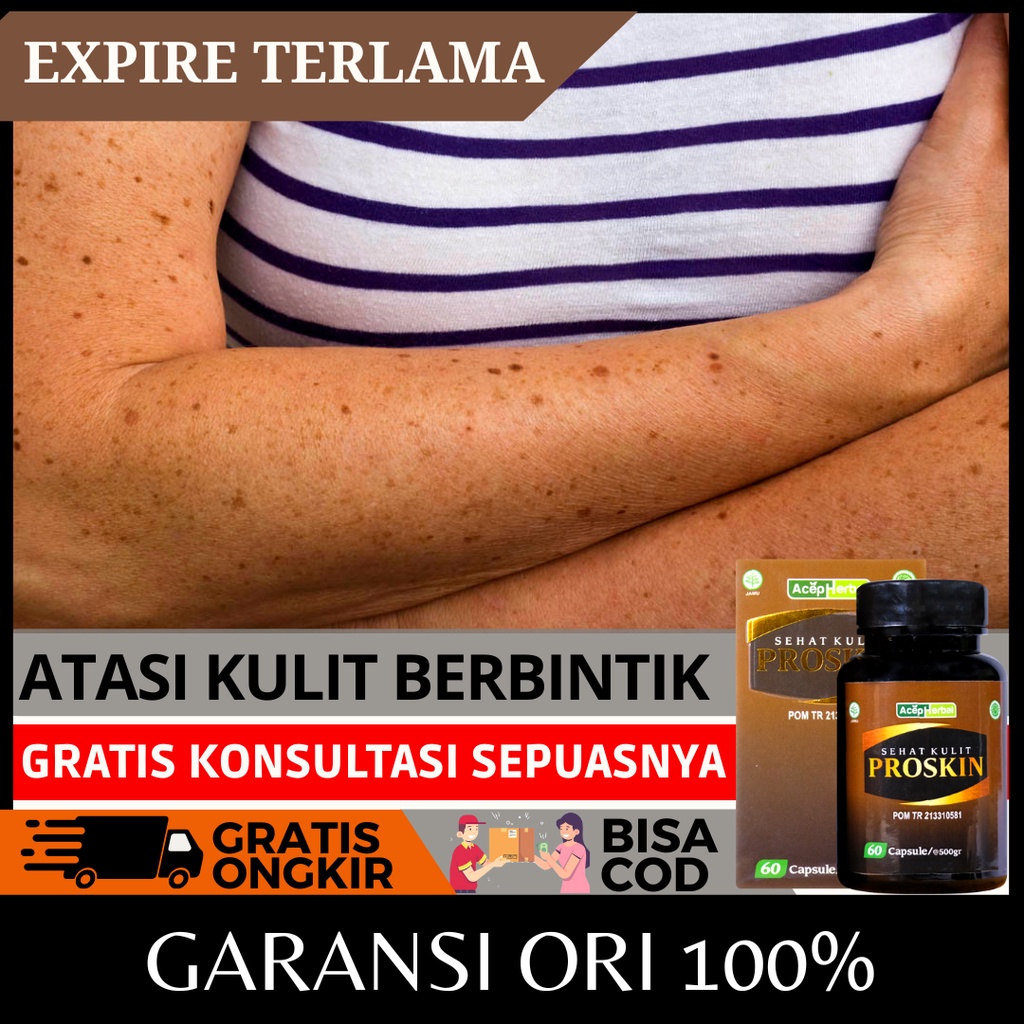 Jual Obat Kulit Bintik Hitam Keratosis Pilaris Seboroik Penyakit Kulit Ayam Penghilang Gatal