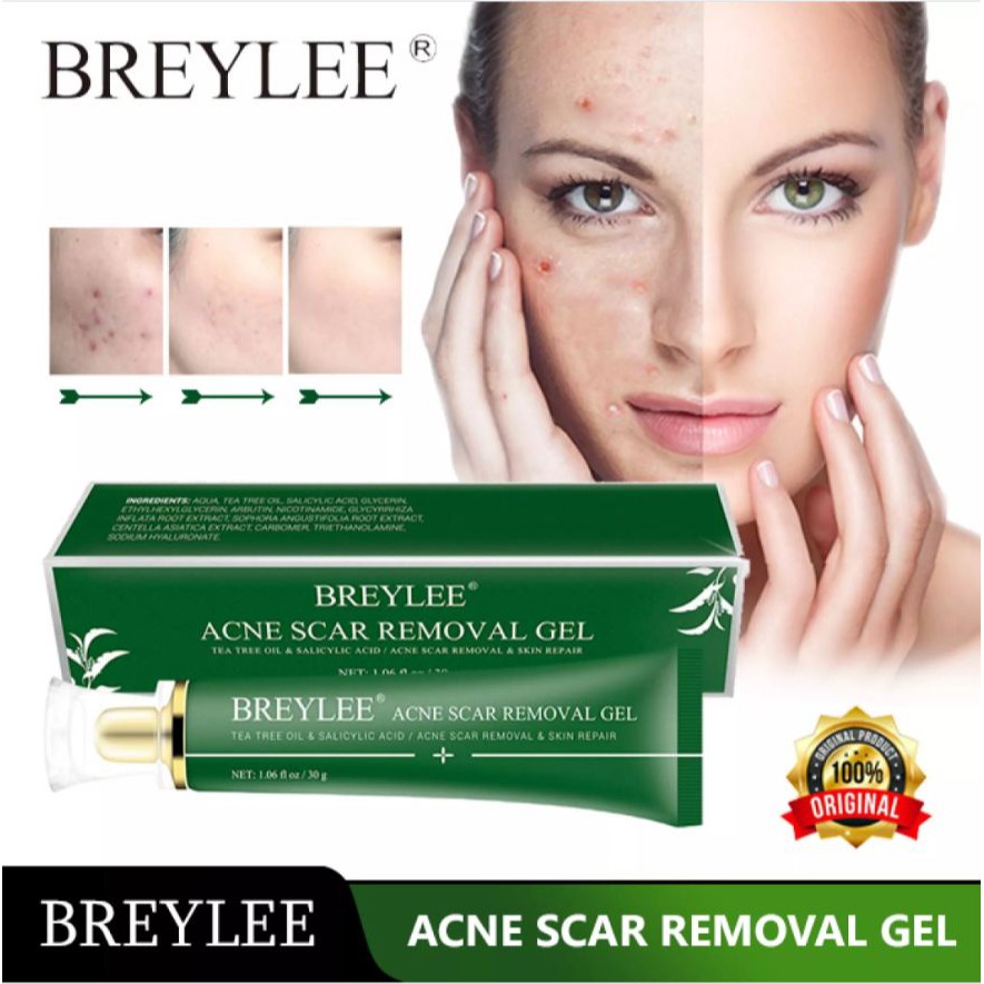 Jual Acne Scar Removal Gel Penghilang Bekas Luka Jerawat BintikBintik