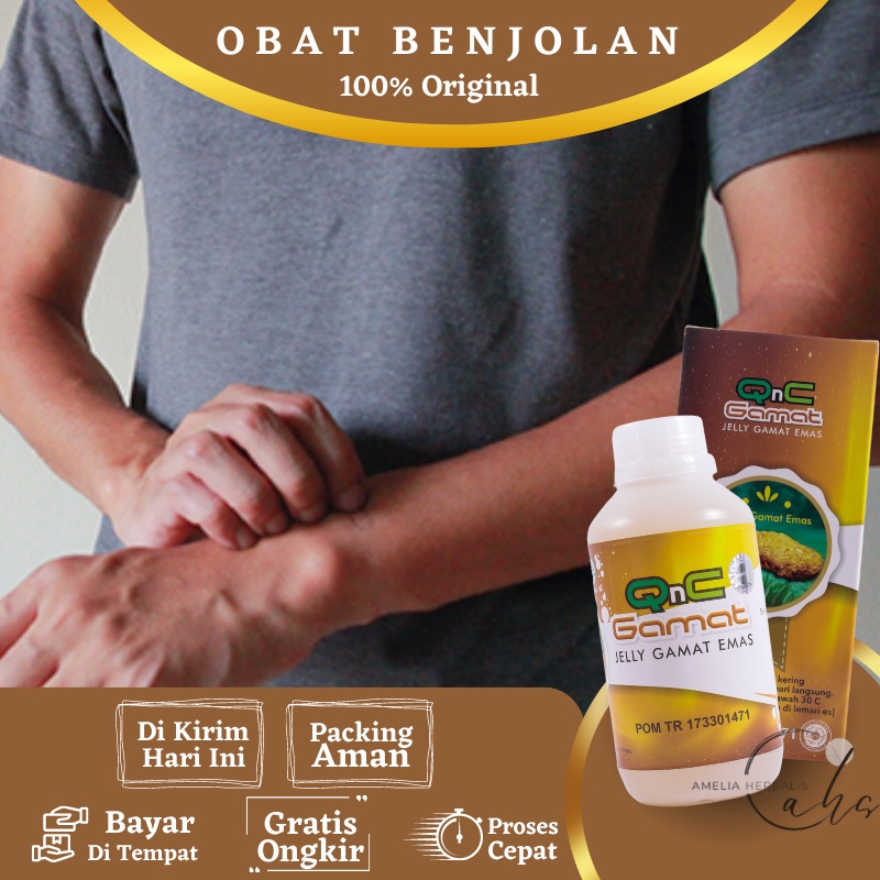 Jual Obat Benjolan, Obat Benjolan Di Tangan, Obat Penghilang Benjolan ...