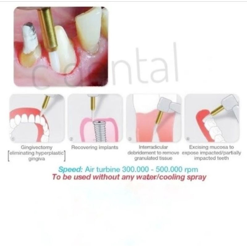 Jual Dental Surgical Bur Cutting Trimmer Gingiva Reusable Bahan Ceramic