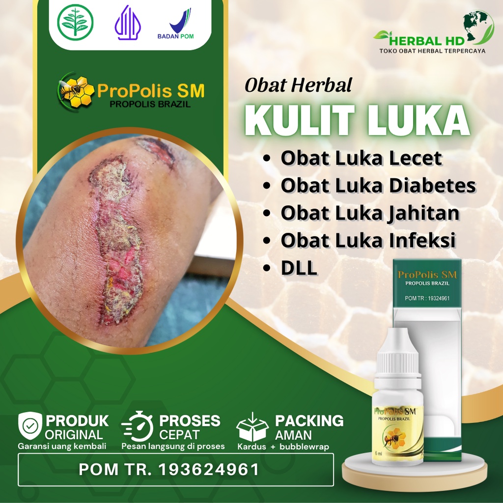 Jual Obat Pengering Luka Basah, Diabetes Basah, Bakar, Jahitan, Sunat