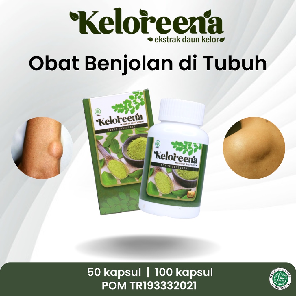 Jual Obat Benjolan Di Tubuh Leher Payudara Tangan Uci Uci Lipoma Tiroid ...