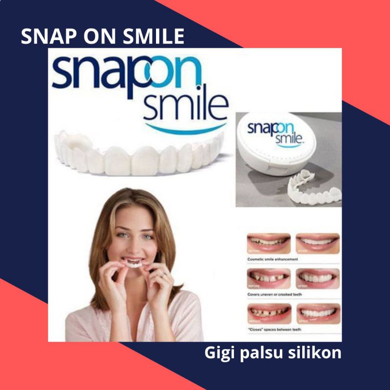 Jual Gigi Palsu Instan Atas Bawah Snap On Smile Untuk Ompong / snap on ...