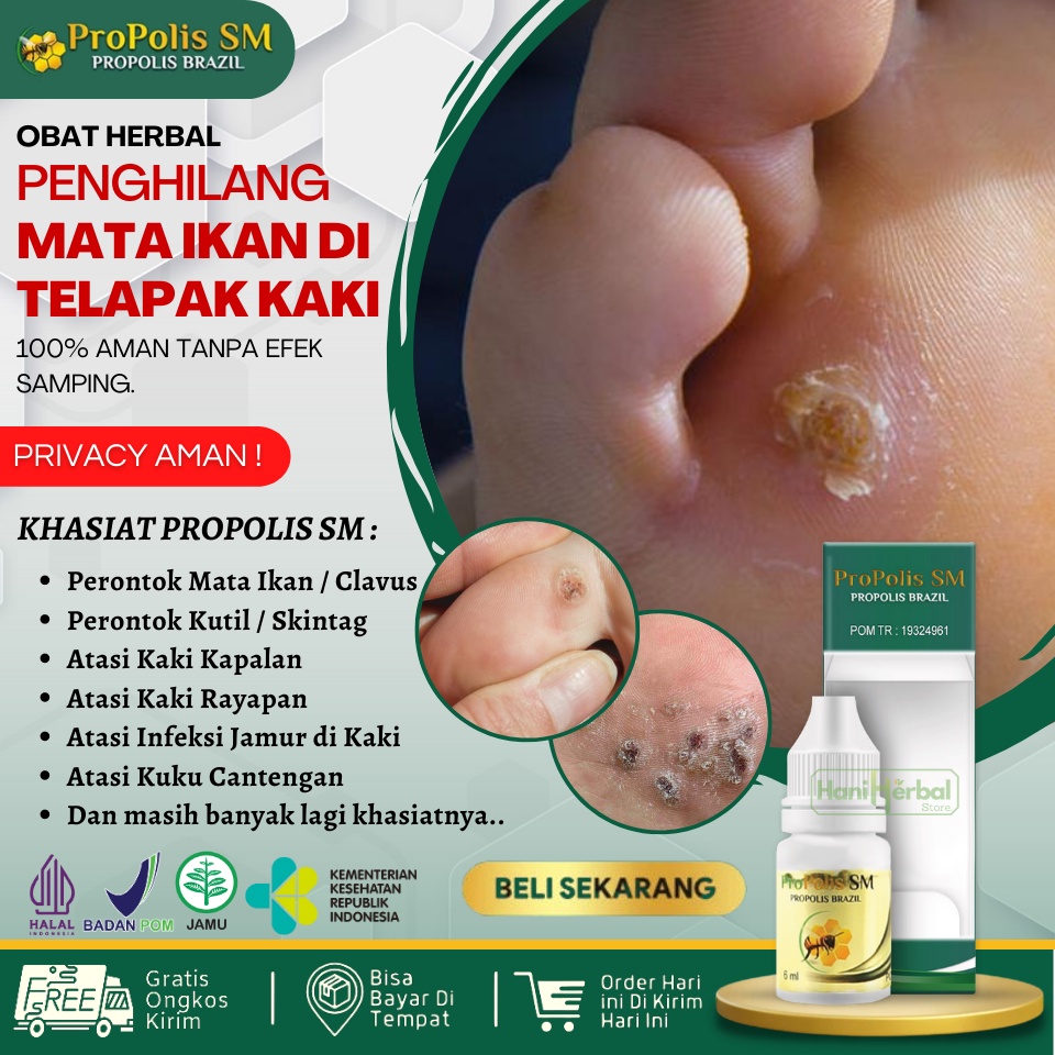 Jual Obat Tetes Penghilang Mata Ikan Di Telapak Kaki Propolis Sm Brazillian Ml Obat Tetes