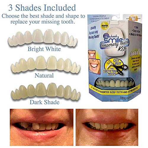 Jual Penambal Gigi Ompong Gigi Gingsul Instant Smile Temporary Tooth