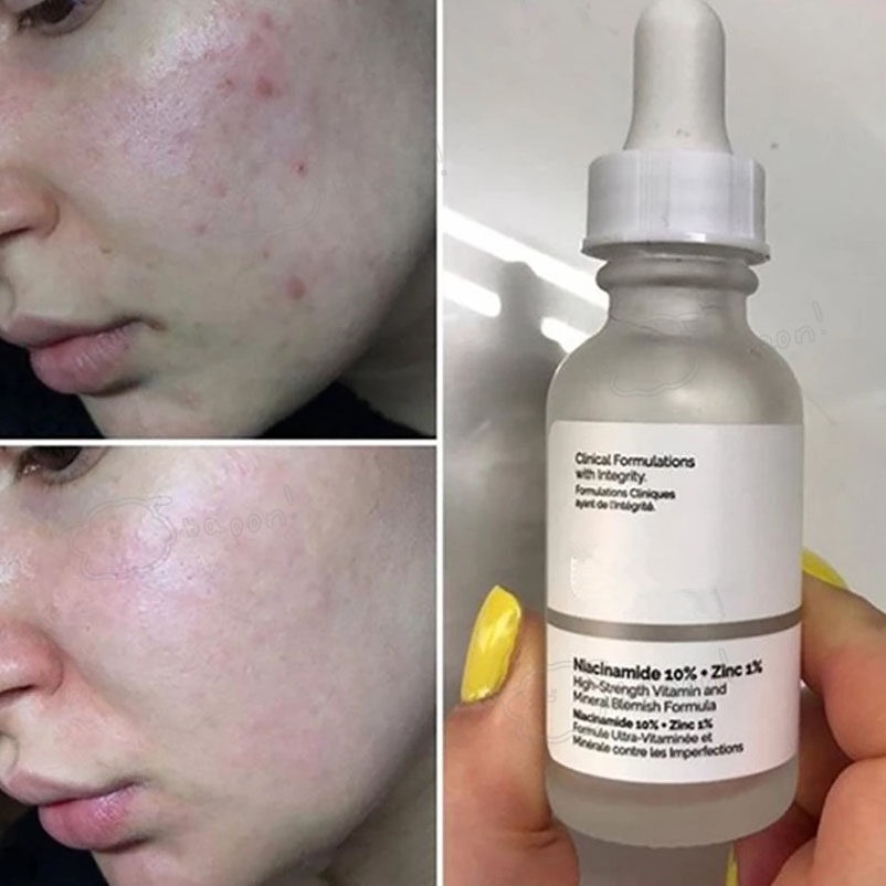 Jual The Ordinary Niacinamide/AHABHA Peeling/Alpha arbutin/Caffeine ...