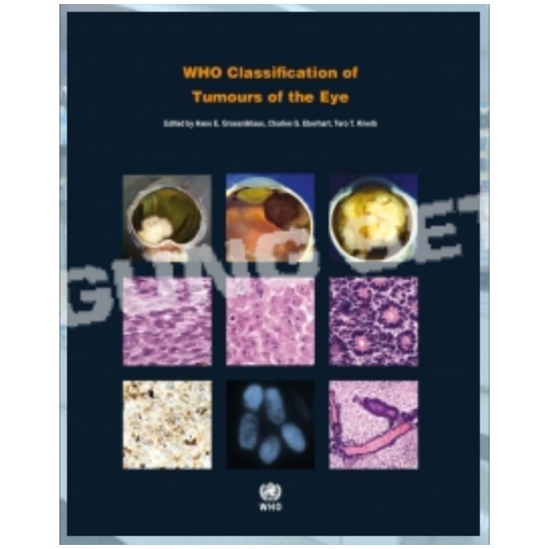 Jual WHO CLASSIFICATION OF TUMOURS OF THE EYE 4E - HANS E GROSSNIKLAUS ...