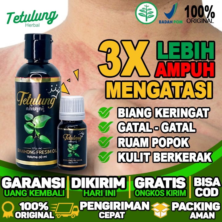 Jual Obat Salep Gatal Biang Keringat Dan Bintik Merah Di Kulit Yang Tak