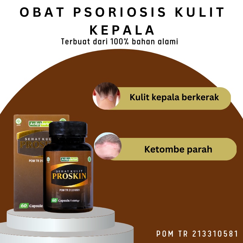 Jual Kaka Herbal Obat Ketombe Berkerak Di Kulit Kepala Obat Ketombe