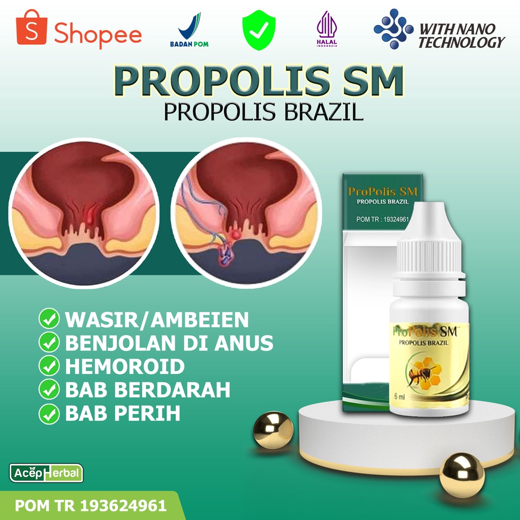 Jual Obat Oles Wasir Ambeien Benjolan Anus Hemoroid Wasir Luar Dan ...