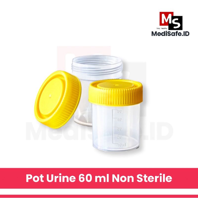 Jual Urine Container 60 Ml Non Steril Pot Urin / Satuan | Shopee Indonesia