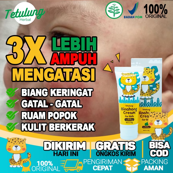 Jual Obat Salep Biang Keringat Pada Anak Yang Tak Kunjung Sembuh Dan