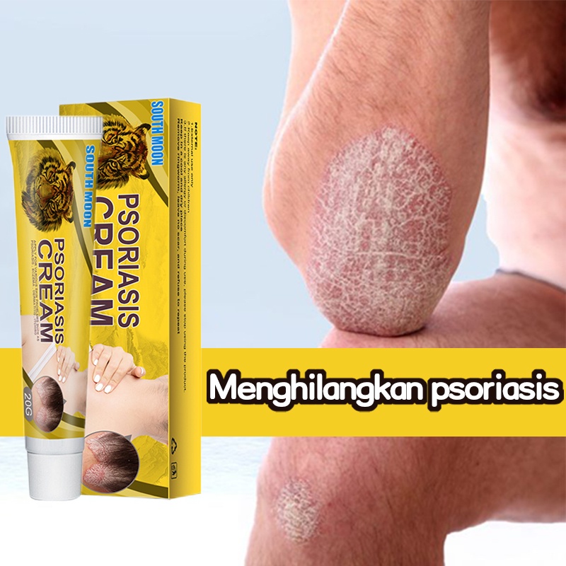 Jual Salep gatal Salep Eksim Salep kulit Krim psoriasis paling ampuh