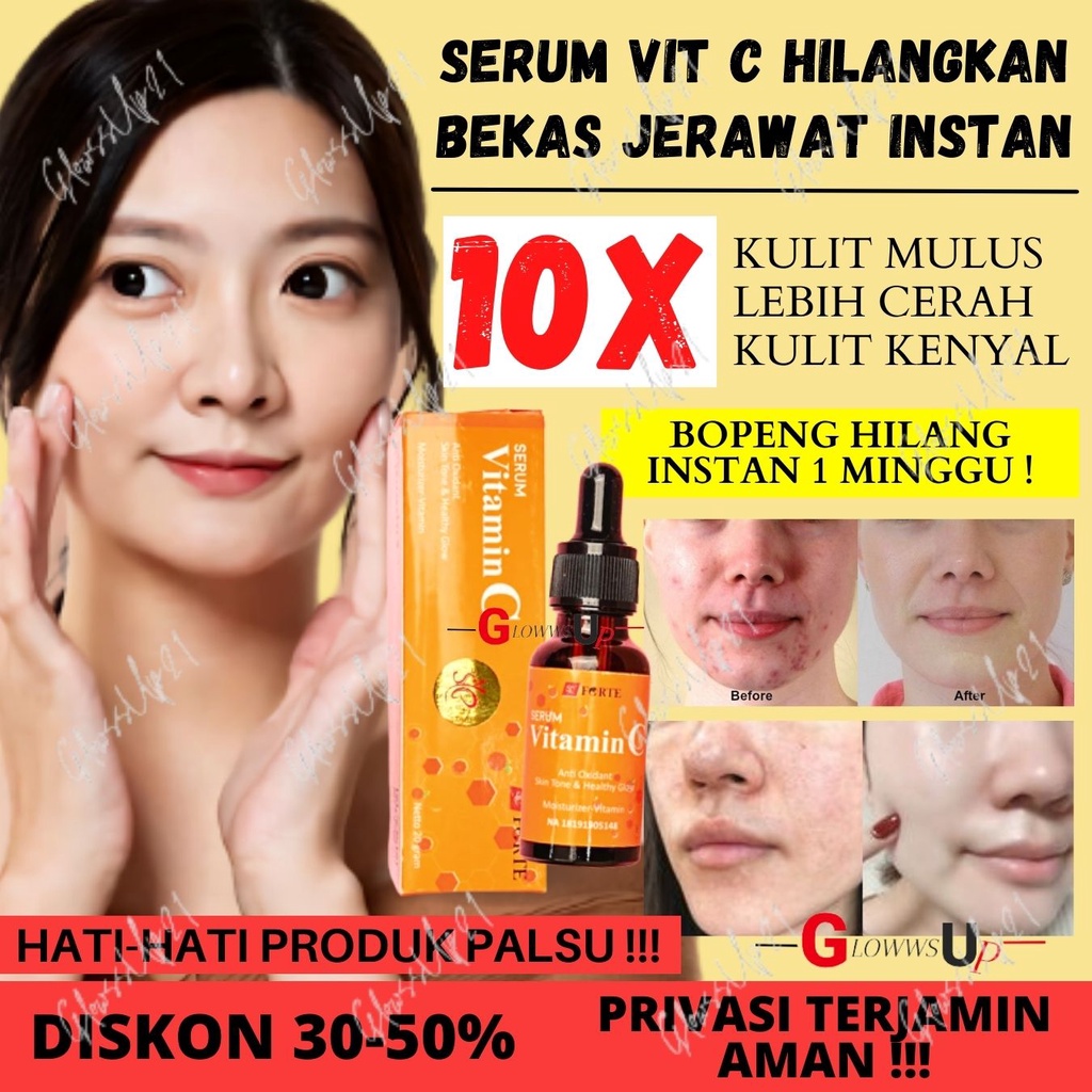 Jual SYB FORTE SERUM VITAMIN C ORANGE 20GR - VITAMIN C SYB FORTE ...
