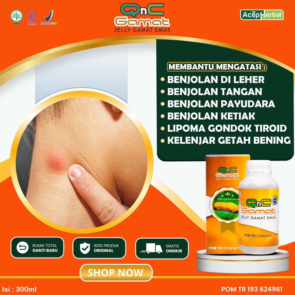 Jual Obat Oles Benjolan Di Leher Kelenjar Getah Bening Benjolan Di