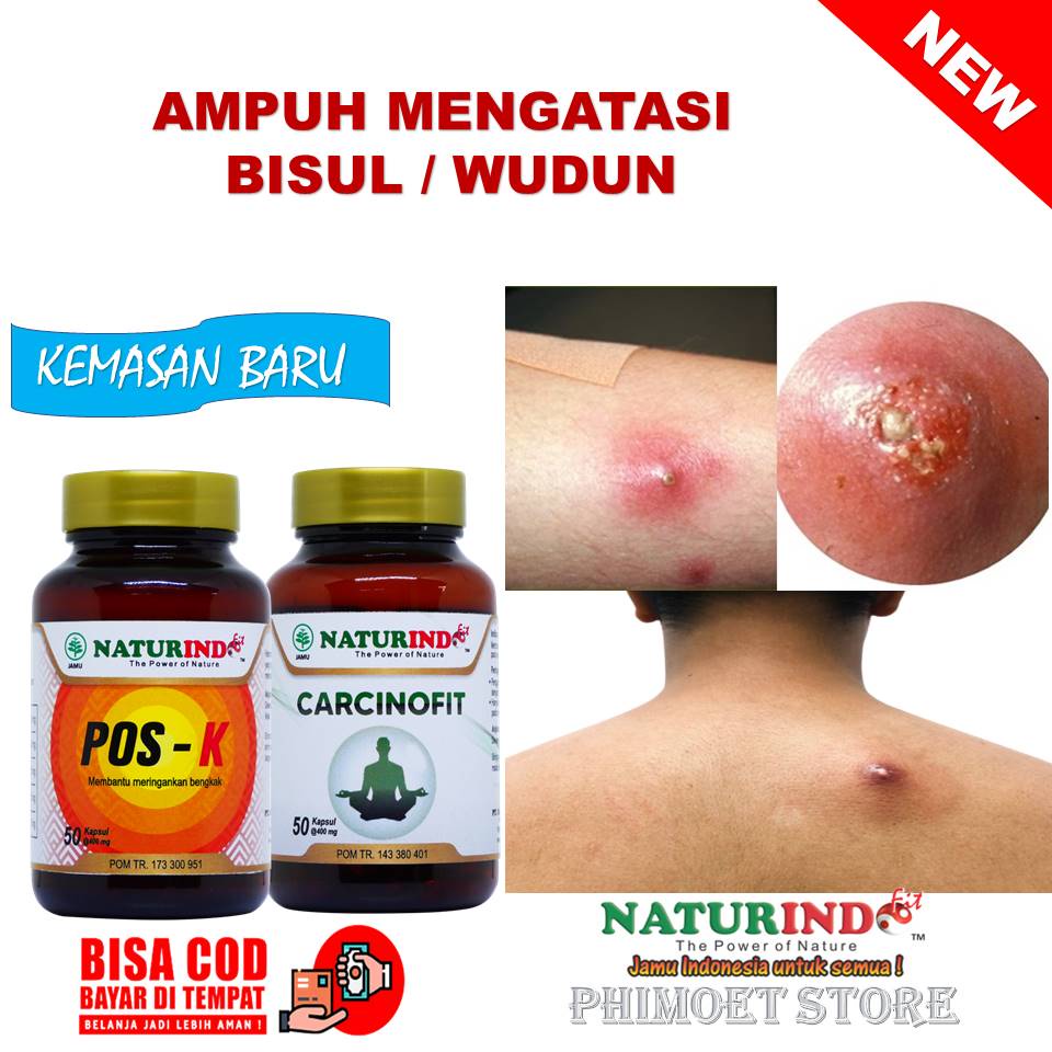 Jual Obat Bisul Jerawat Bernanah Bisul Di Punggung Wudun Conon Herbal Bisul Carcinofit Naturindo 