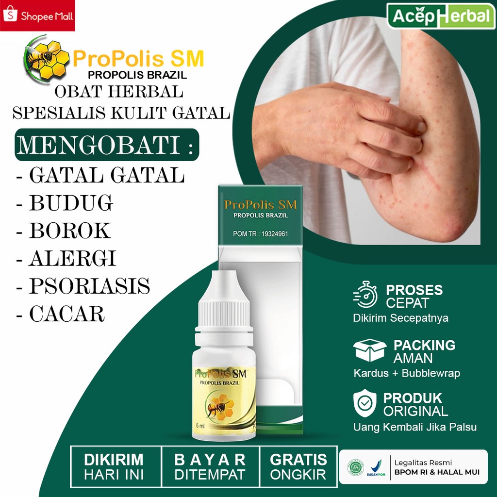 Jual Obat Gatal Untuk Seluruh Tubuh Obat Kulit Gatal Berair Budug Borok Bintik Bintik Merah 5243