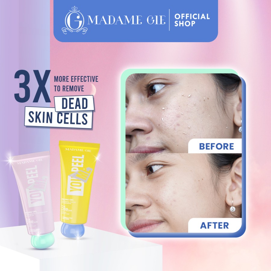Jual MADAME GIE Madame You Peel Me Peeling Gel, 100 g Shopee Indonesia