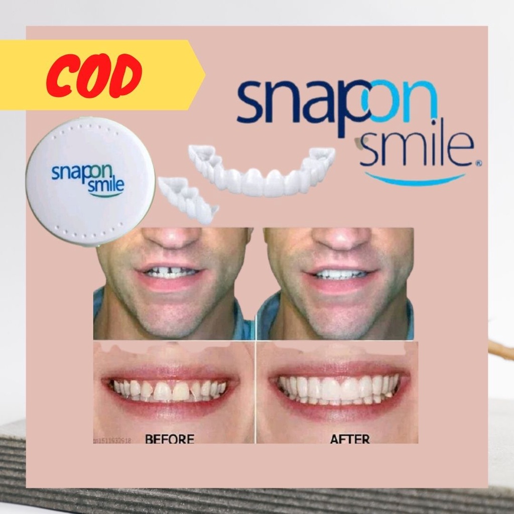 Jual Halal COD Snap On Smile 100 % Venners Gigi Original 100% 1Set Atas ...