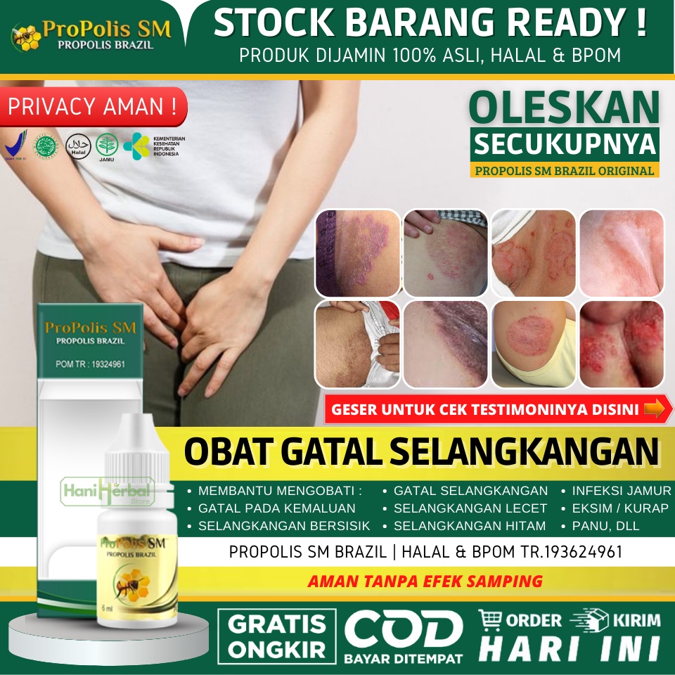 Jual Obat Untuk Selangkangan Lecet, Selangkangan Hitam, Selangkangan