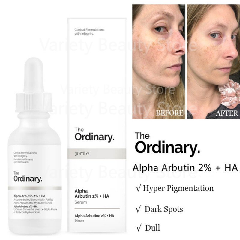 Jual The Ordinary Niacinamide 10% + Zinc 1% / The Ordinary Alpha ...