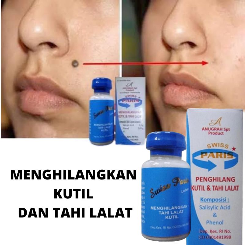 Jual SWISS PARIS LOTION 100 ORIGINAL OBAT PENGHILANG KUTIL DAN TAHI