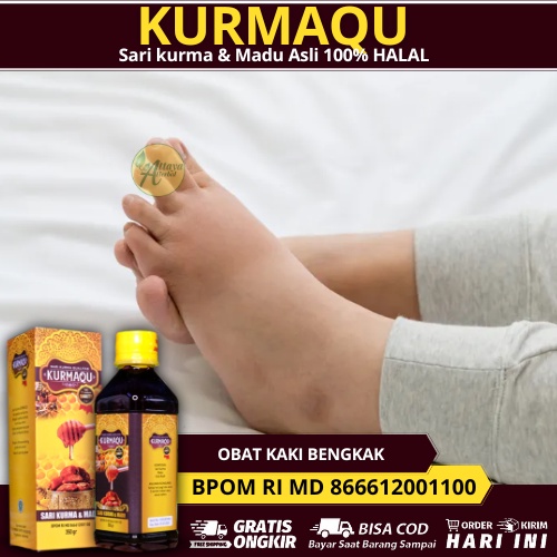 Jual Obat Kaki Bengkak Dan Nyeri, Obat Kaki Bengkak Karena Asam Urat