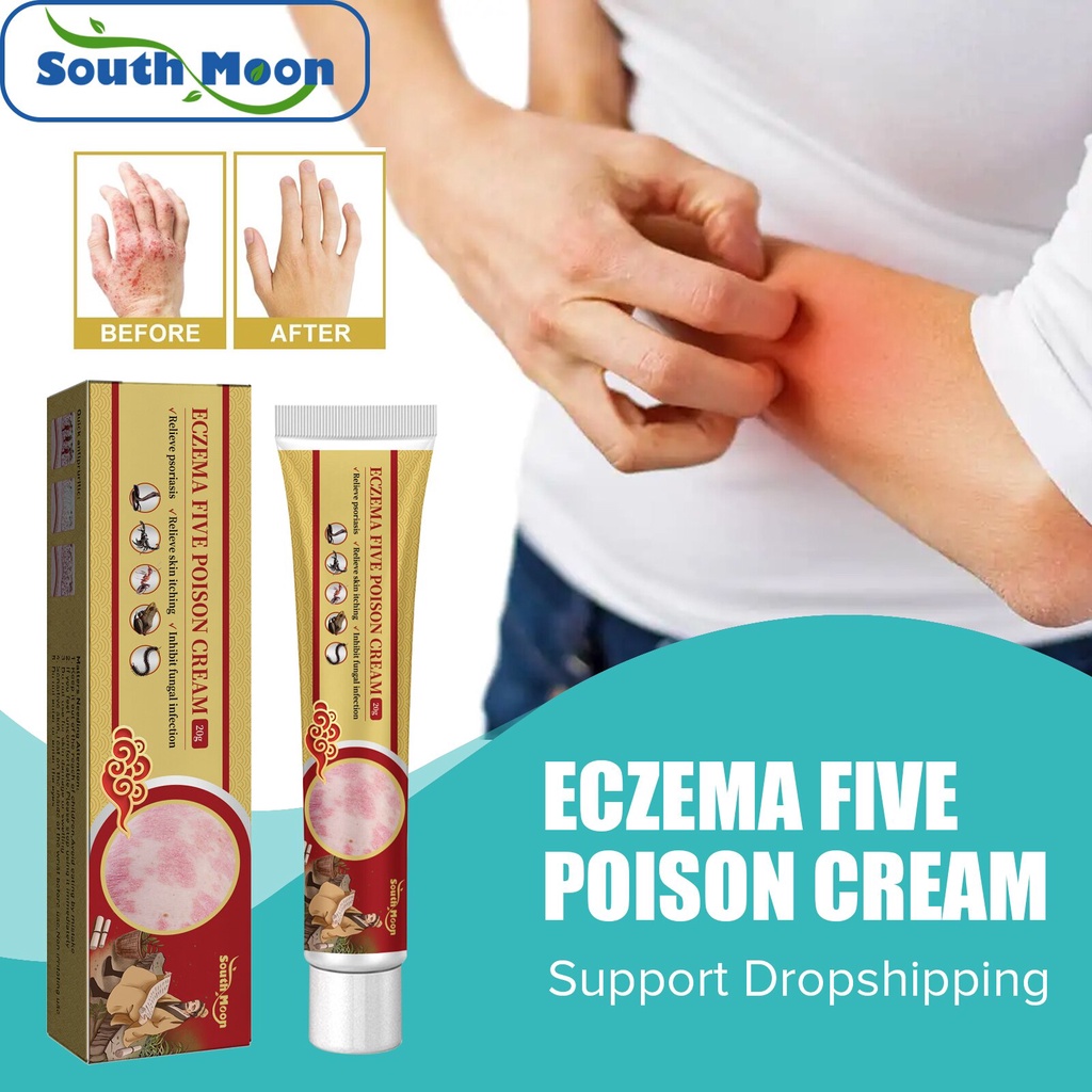 Jual PREORDER South Moon Eczema Cream Treatment Psoriasis Eczematoid Urticaria Desquamation Skin
