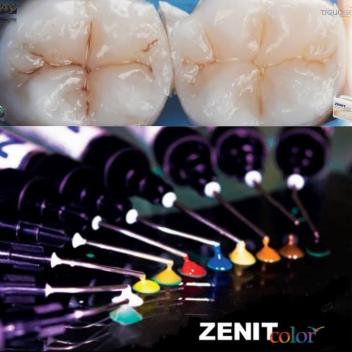 Jual Composite Staining Zenit Colour Untuk Stain Pacific Dental