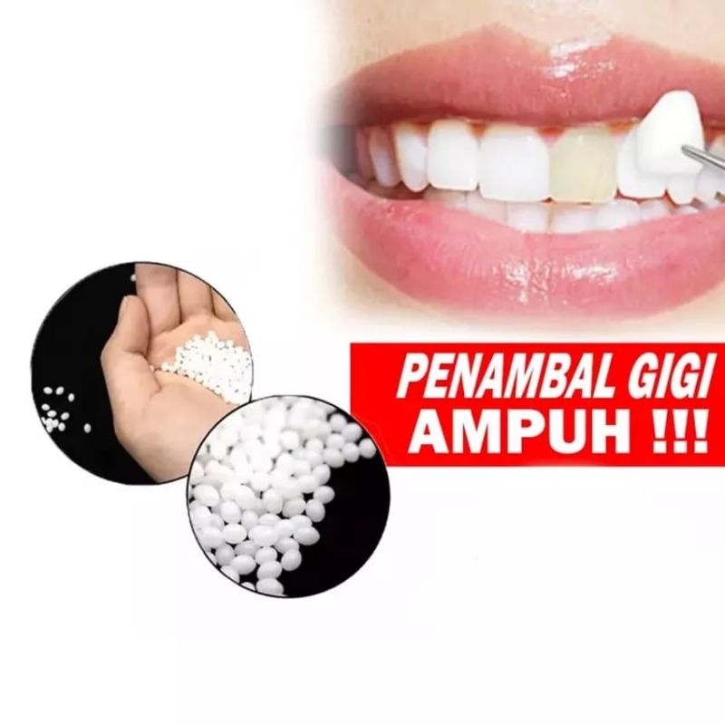 Jual Gfz Penambal Gigi Berlubang Pengganti Gigi Patah Ampuh Gigi Palsu Temptoot Butir 5025