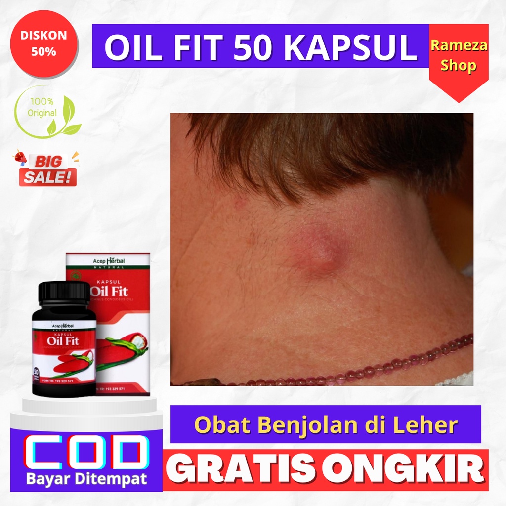 Jual Obat Benjolan Di Leher - Obat Uci-uci - Benjolan Berisi Cairan ...