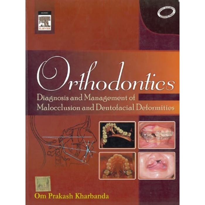 Jual Pdf Orthodontics Diagnosis And Management Of Malocclusion And ...