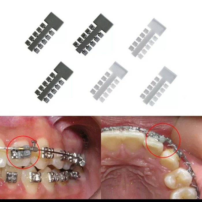 Jual Dental Orthodontic Rotation Wedge Elastomeric Torsion Pad | Shopee ...