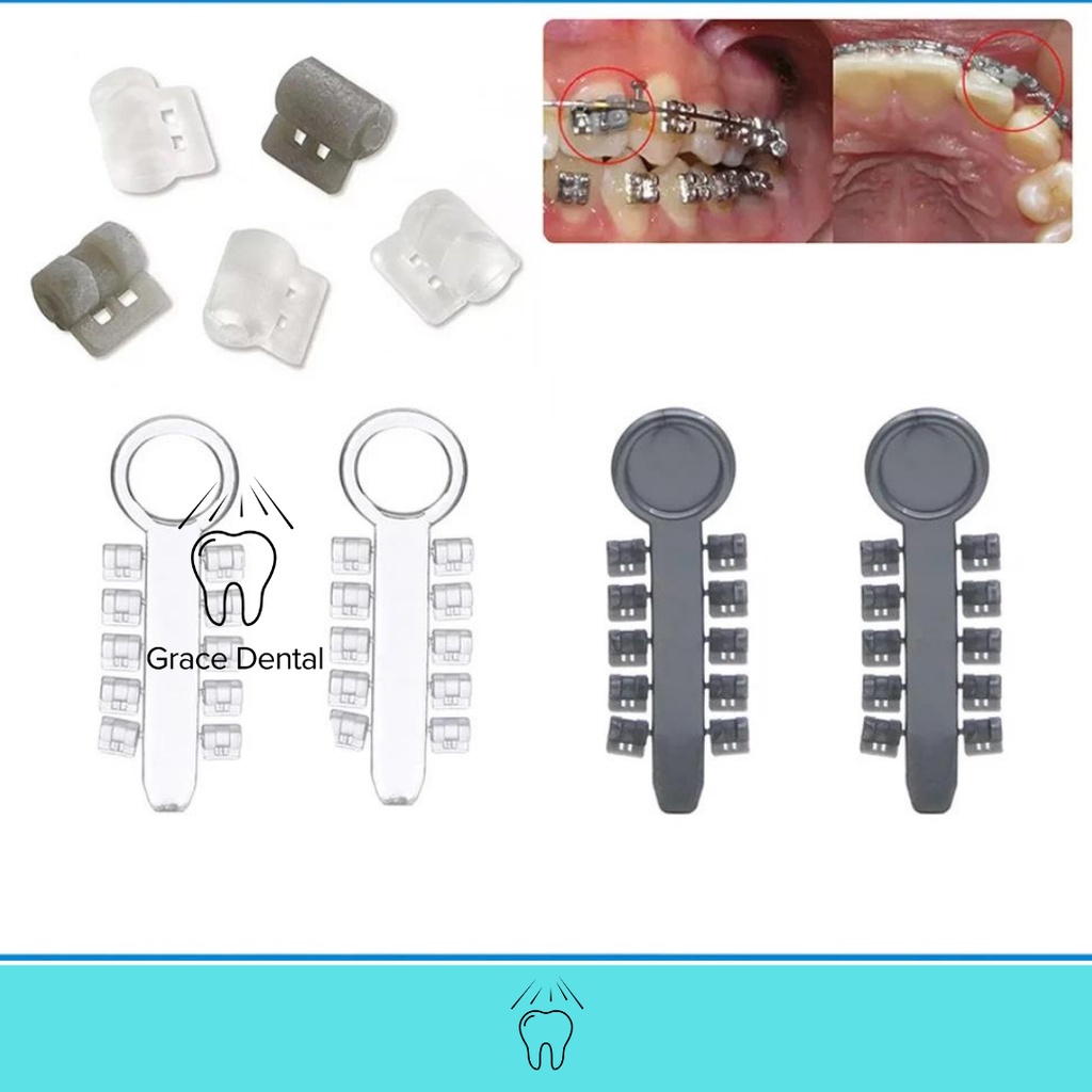 Jual Rotation Wedges Orthodontic Shopee Indonesia