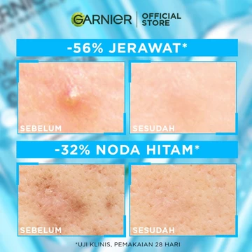 GARNIER Micellar Water Blue Salicylic Acid 125ml Skincare Cleansing Skincare Pembersih Wajah