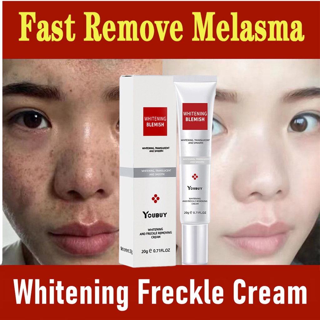 Jual Whitening Freckle Cream Remove Melasma Cream Remove Dark Spots ...