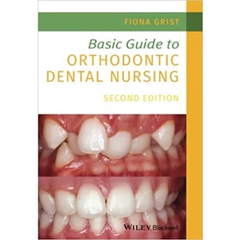 Jual Buku Basic Guide to Orthodontic Dental Nursing 2nd edition ...