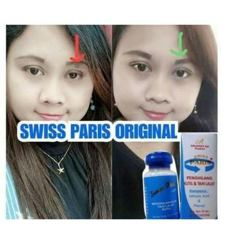 Jual Swiss Paris Lotion Penghilang Kutil dan Tahi Lalat Original