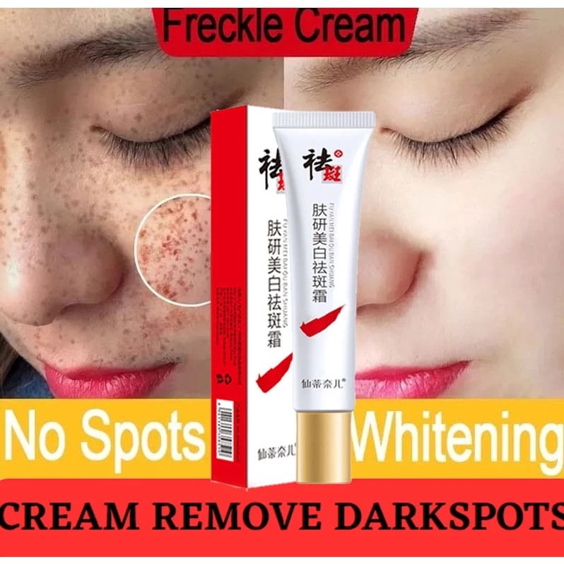 Jual Whitening Freckle Cream Remove Dark Spots Salep Penghilang Flek Hitam Bintik Shopee Indonesia 8852