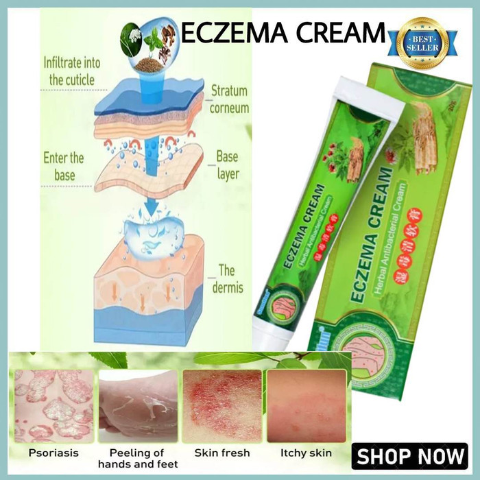 Jual CREAM ECZEMA SUMIFUN 20GR ORIGINAL SALEP GATAL RUAM DAN EKSIM DI ...